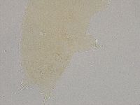 Ramazzottius oberhaeuseri image