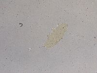 Ramazzottius oberhaeuseri image