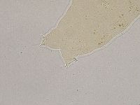 Ramazzottius oberhaeuseri image