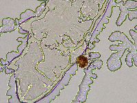 Ramazzottius oberhaeuseri image