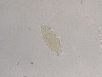 Ramazzottius oberhaeuseri image