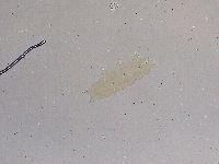 Ramazzottius oberhaeuseri image