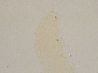 Ramazzottius oberhaeuseri image