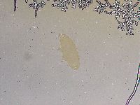 Ramazzottius oberhaeuseri image
