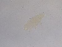 Ramazzottius oberhaeuseri image