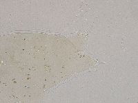 Ramazzottius oberhaeuseri image