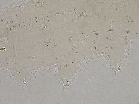 Ramazzottius oberhaeuseri image