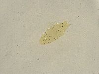 Ramazzottius oberhaeuseri image