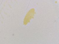 Ramazzottius oberhaeuseri image