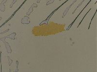 Ramazzottius oberhaeuseri image