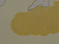 Ramazzottius oberhaeuseri image