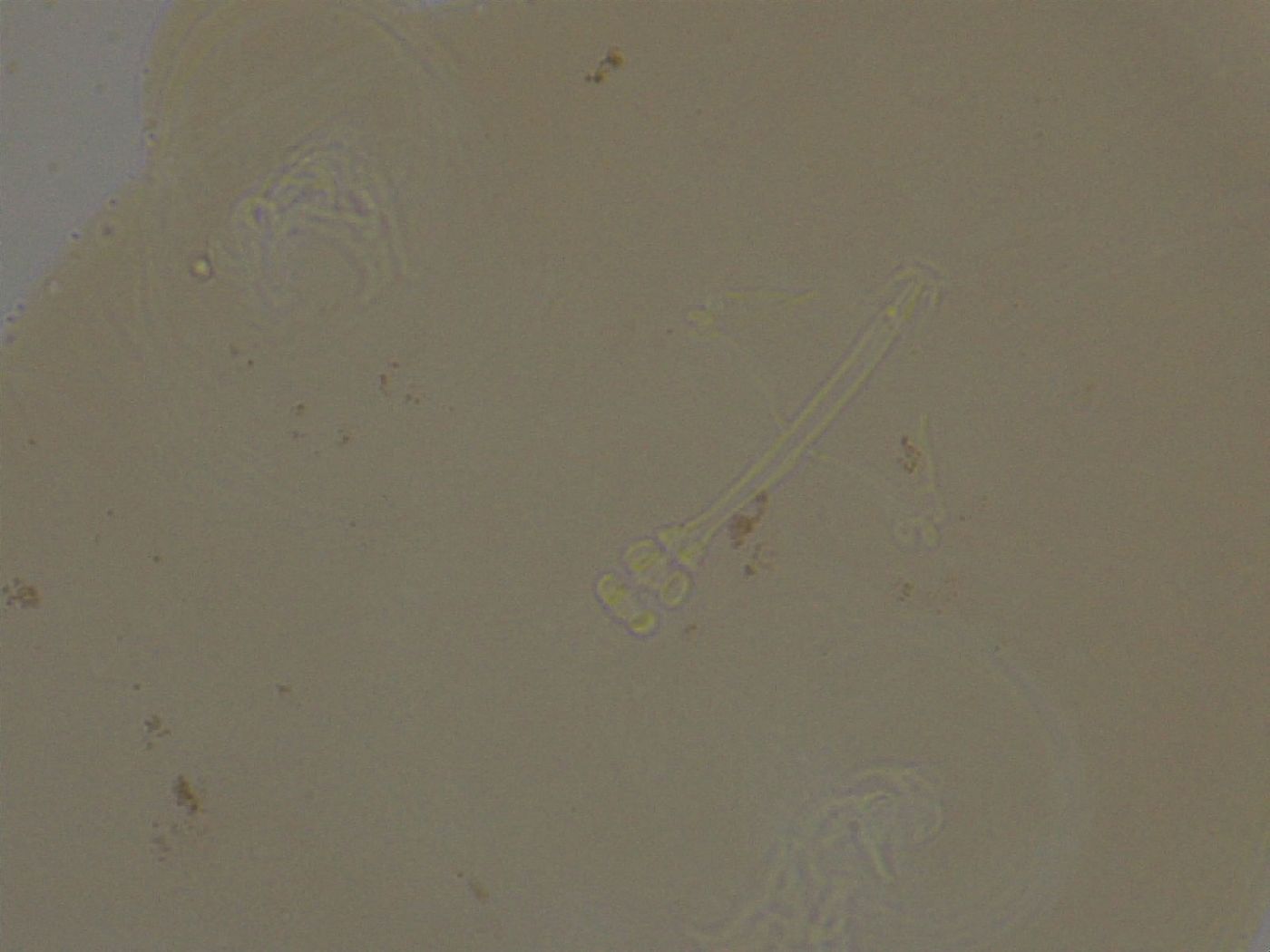Ramazzottius oberhaeuseri image
