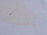 Ramazzottius oberhaeuseri image
