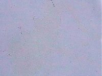 Ramazzottius oberhaeuseri image