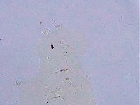 Ramazzottius oberhaeuseri image