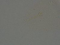 Ramazzottius oberhaeuseri image
