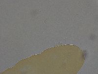 Ramazzottius oberhaeuseri image