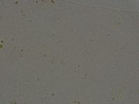 Ramazzottius oberhaeuseri image