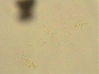 Ramazzottius oberhaeuseri image