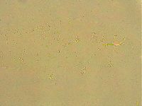 Ramazzottius oberhaeuseri image
