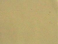 Ramazzottius oberhaeuseri image