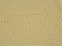 Ramazzottius oberhaeuseri image