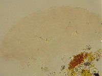 Ramazzottius oberhaeuseri image