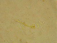 Ramazzottius oberhaeuseri image