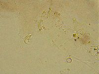 Ramazzottius oberhaeuseri image