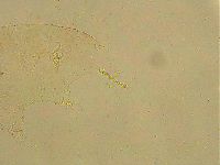 Ramazzottius oberhaeuseri image