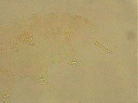 Ramazzottius oberhaeuseri image