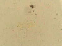 Ramazzottius oberhaeuseri image