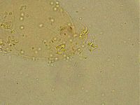 Ramazzottius oberhaeuseri image