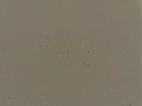 Ramazzottius oberhaeuseri image