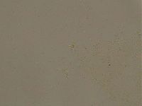 Ramazzottius oberhaeuseri image