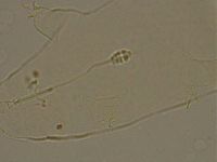 Pilatobius oculatus image