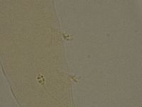Pilatobius oculatus image