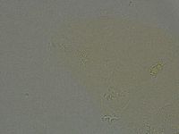 Pilatobius oculatus image
