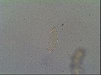 Pilatobius oculatus image