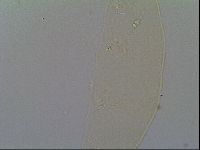 Pilatobius oculatus image