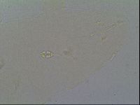 Pilatobius oculatus image