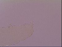 Pilatobius oculatus image