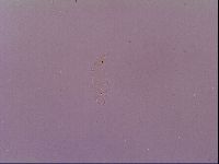 Pilatobius oculatus image