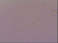 Pilatobius oculatus image