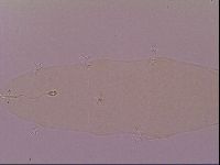 Pilatobius oculatus image