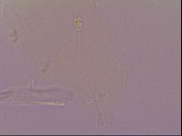 Pilatobius oculatus image