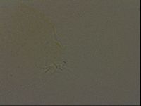 Pilatobius oculatus image