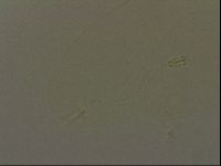 Pilatobius oculatus image