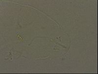 Pilatobius oculatus alpinus image