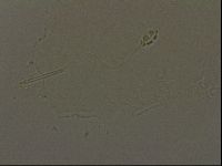 Pilatobius oculatus alpinus image